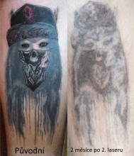 2 měs. po 2 sezení