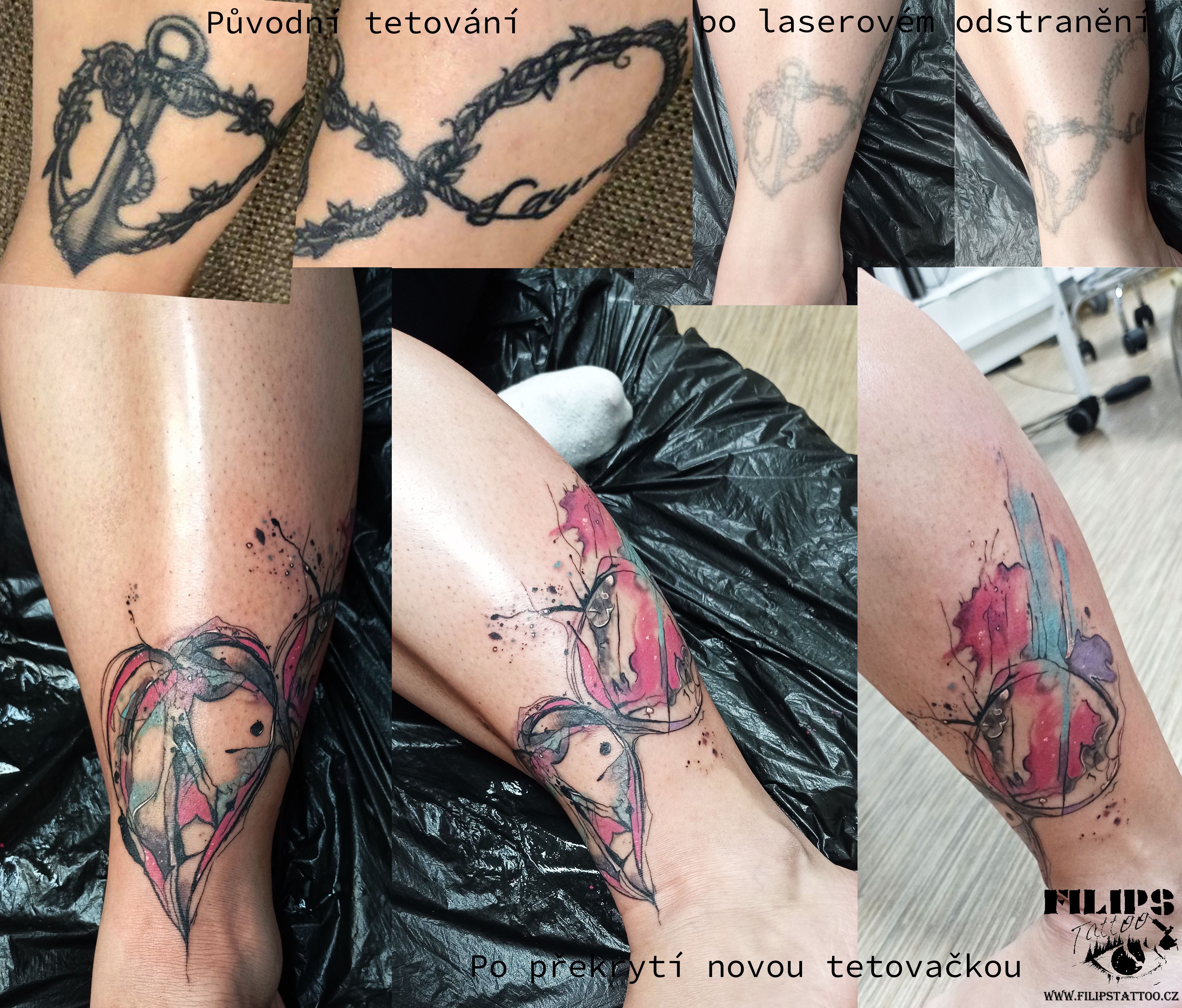 Překrytí starší tmavé tetovačky, které bylo potřeba nejprve zesvětlit laserem, a poté překrýt novou tetovačkou 🙂